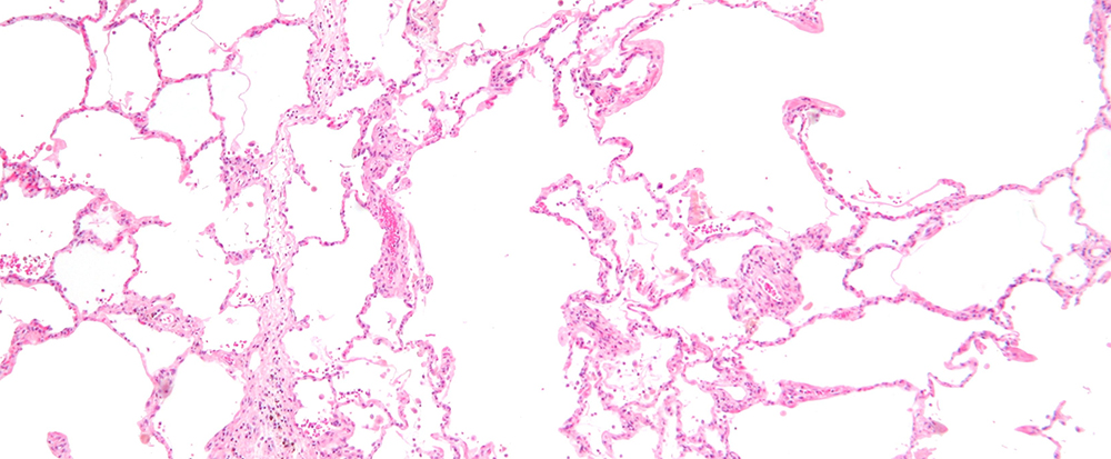 Mikroskopibild av lungstruktur. Foto.